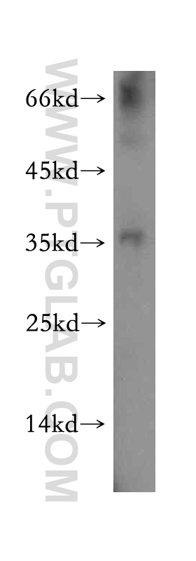 13069-1-AP;human testis tissue