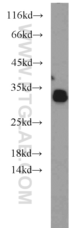 55472-1-AP;human brain tissue