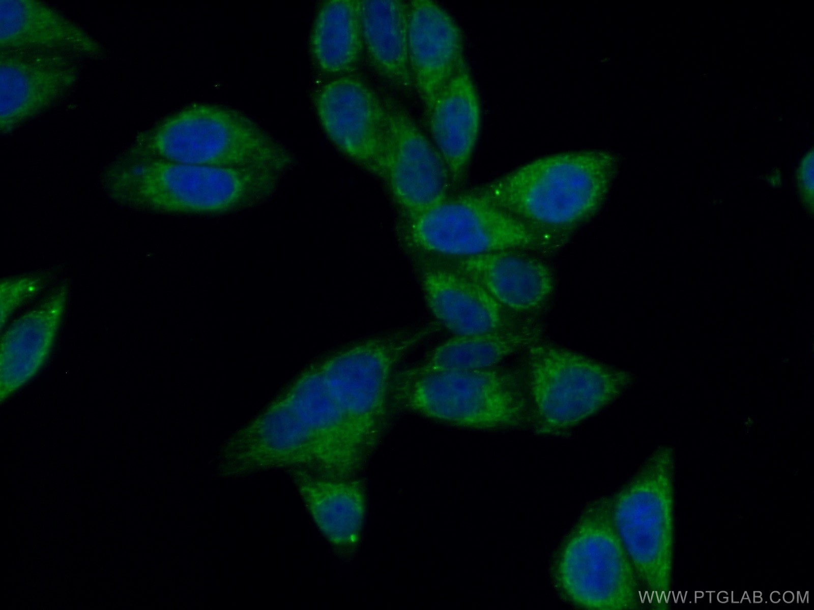 NPC1 Antibody 139261AP Proteintech