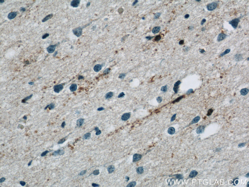 NPC1 Antibody 139261AP Proteintech