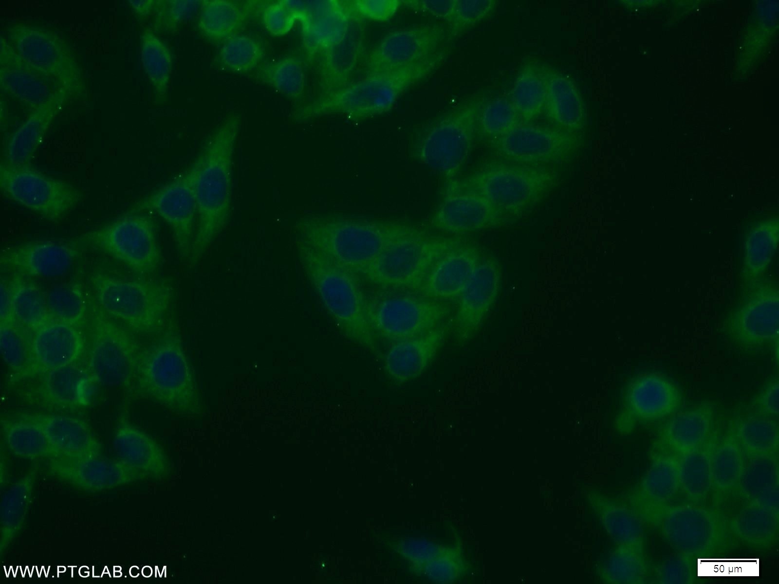 NRG1 Antibody 10527-1-AP | Proteintech