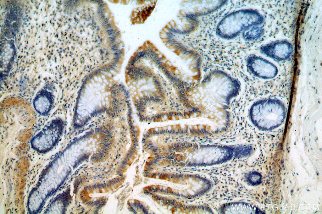 19709-1-AP;human colon