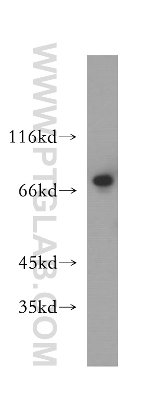 12515-1-AP;A375 cells