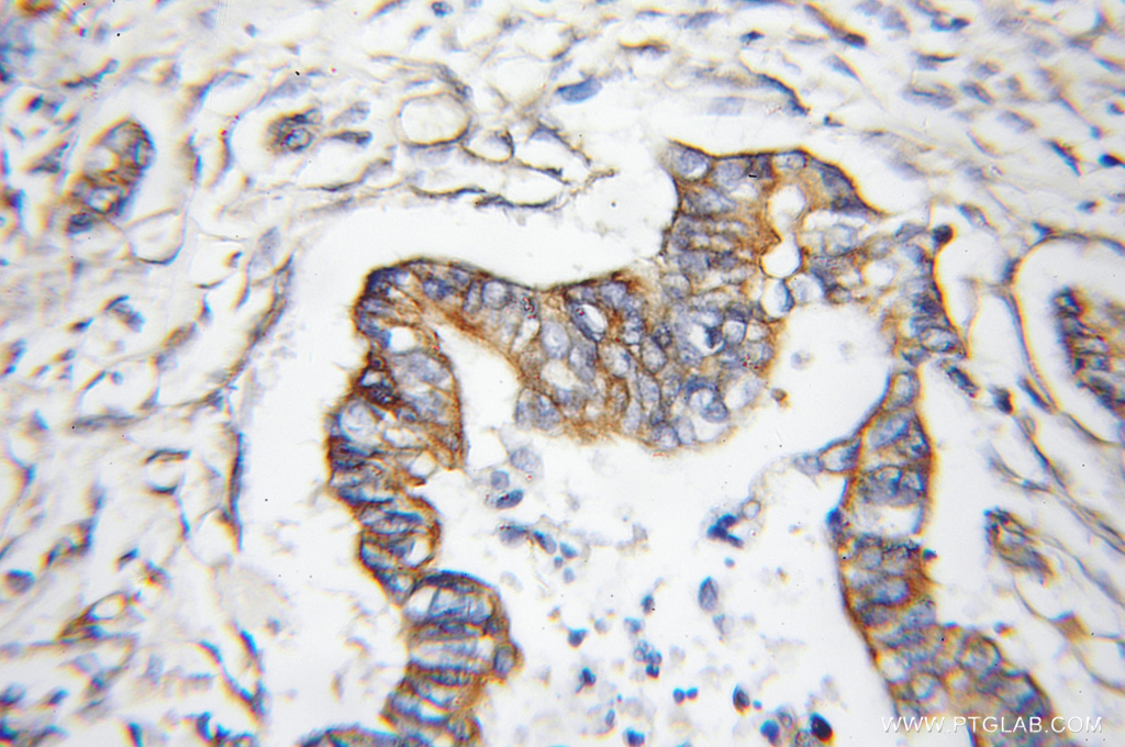 11576-2-AP;human pancreas cancer