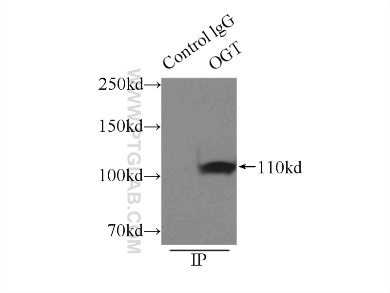 11576-2-AP;mouse brain tissue