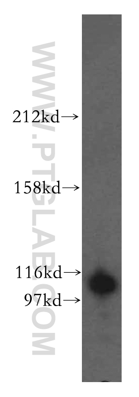 11576-2-AP;human brain tissue
