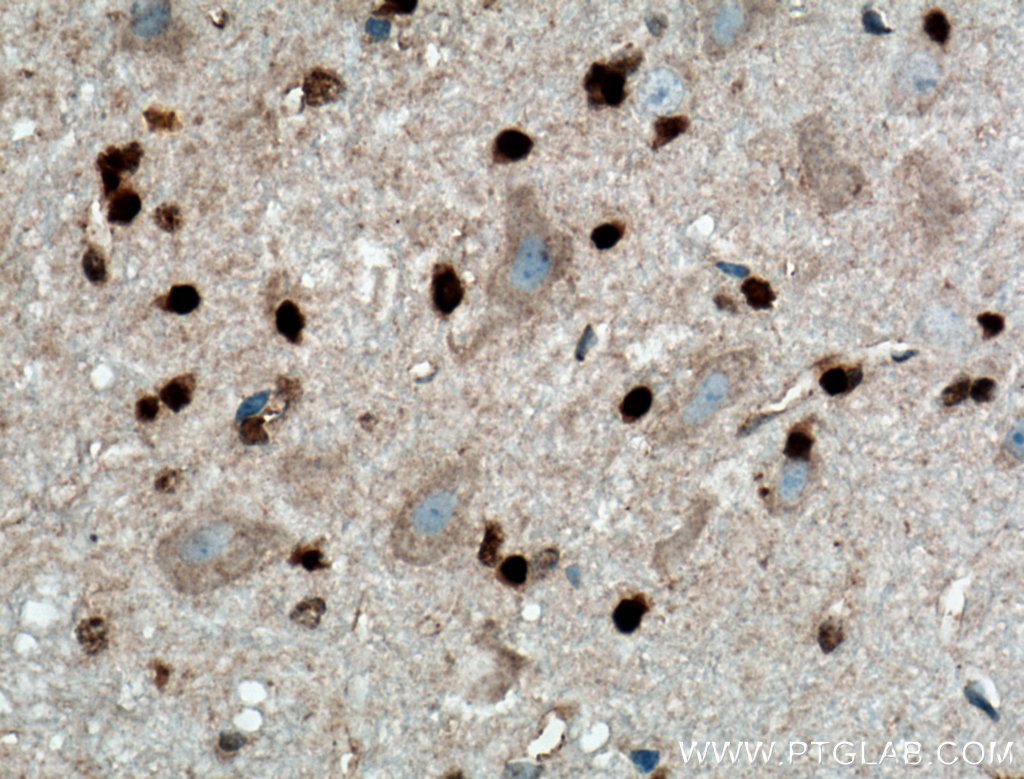 OLIG2 Antibody 13999 1 AP Proteintech olig2-antibody-13999-1-ap-proteintech