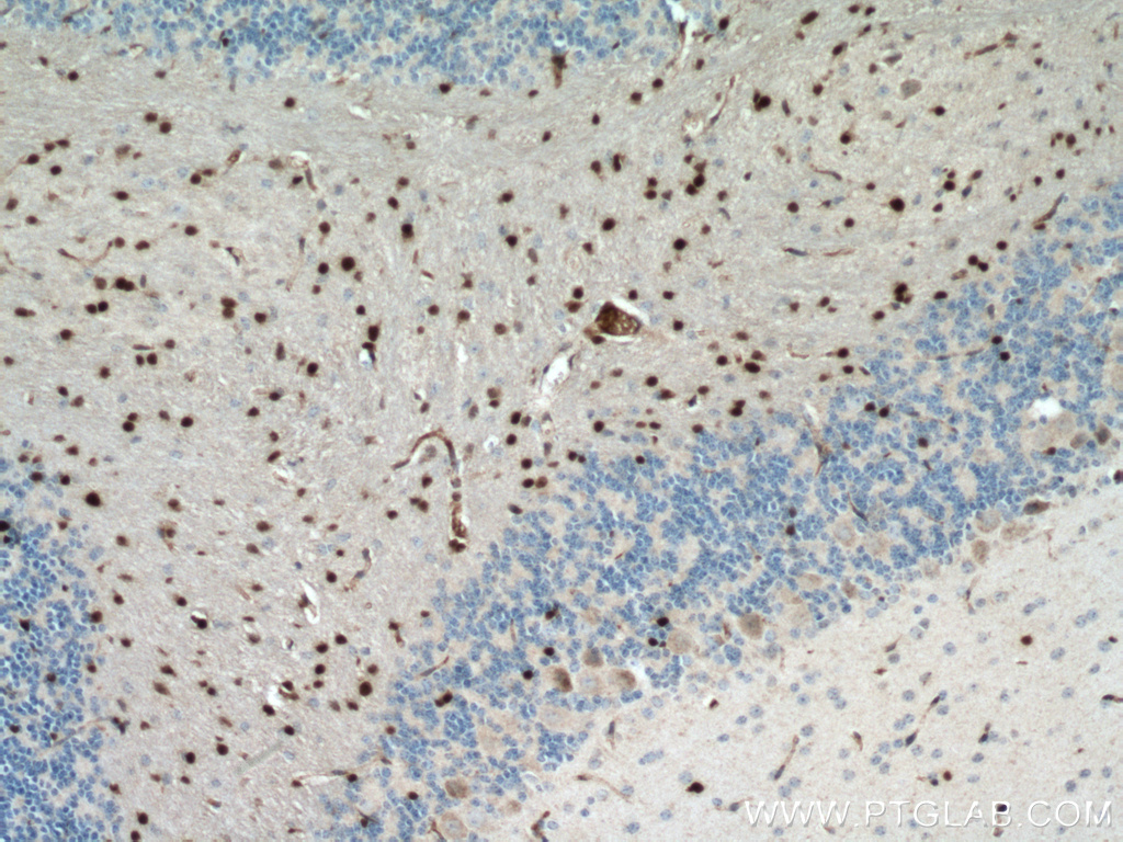 OLIG2 Antibody 13999 1 AP Proteintech olig2-antibody-13999-1-ap-proteintech