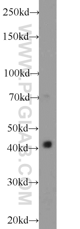 14621-1-AP;mouse brain tissue