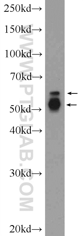 25029-1-AP;mouse brain tissue