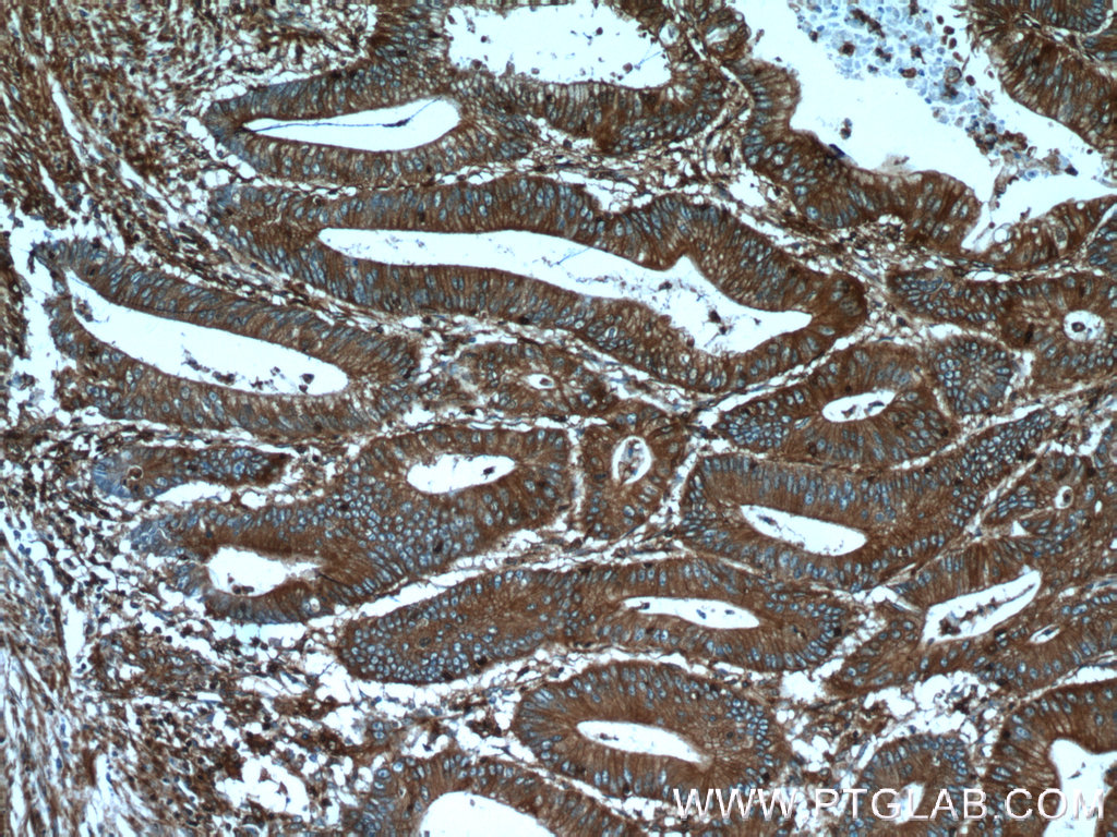 10853-1-AP;human colon cancer tissue