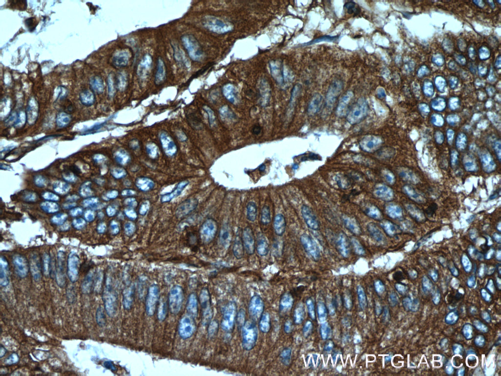 10853-1-AP;human colon cancer tissue