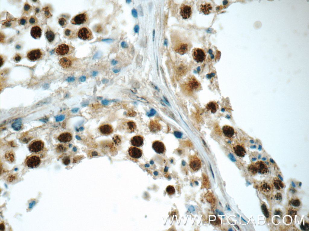 24284-1-AP;human testis tissue