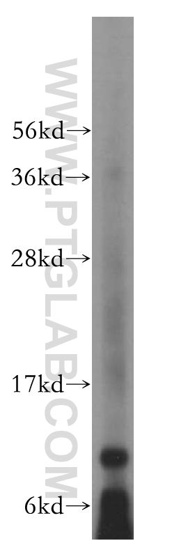 15702-1-AP;mouse pancreas tissue