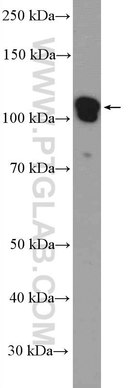 21859-1-AP;PC-3 cells