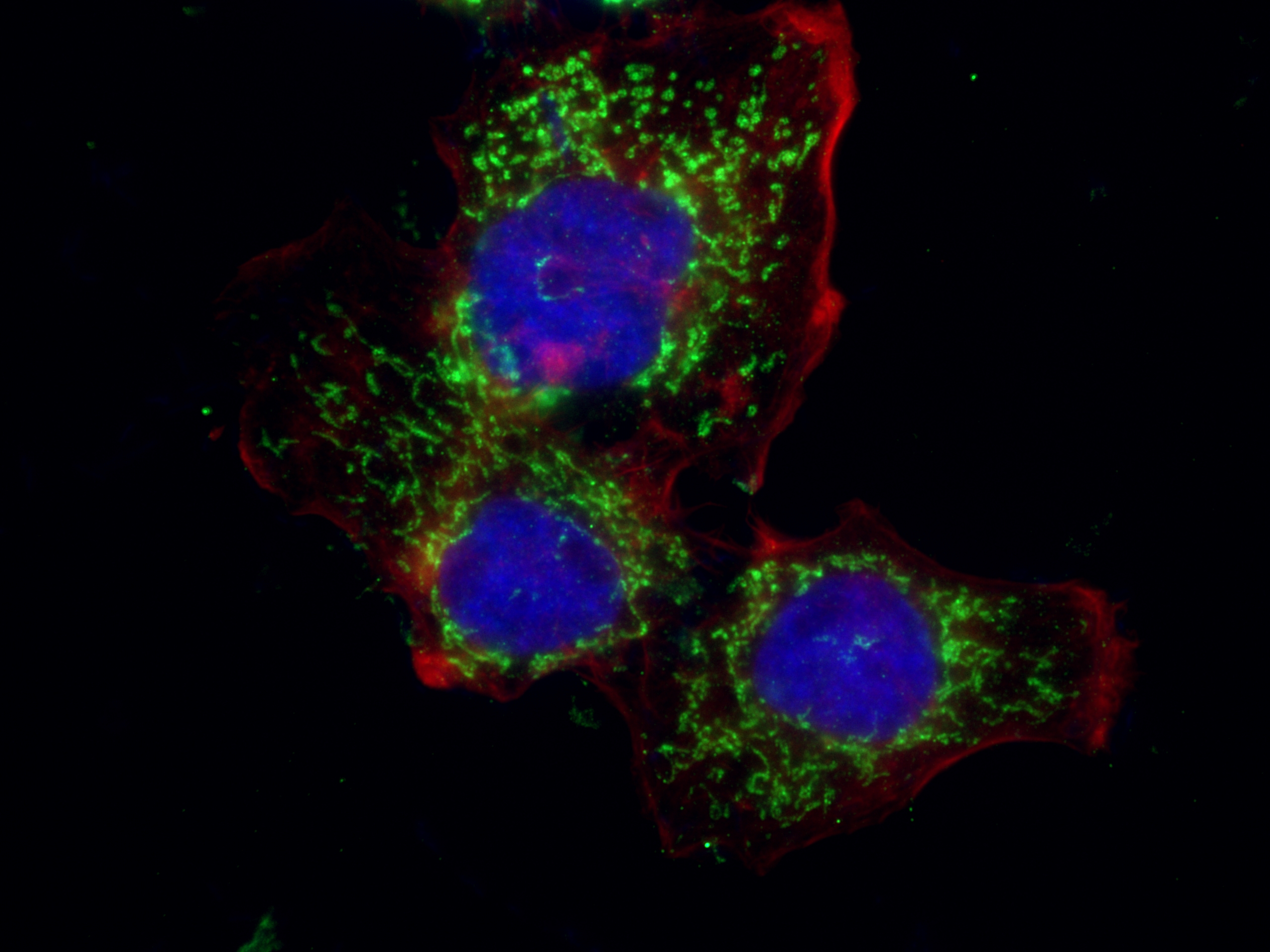 PCK2 Antibody 148921AP Proteintech