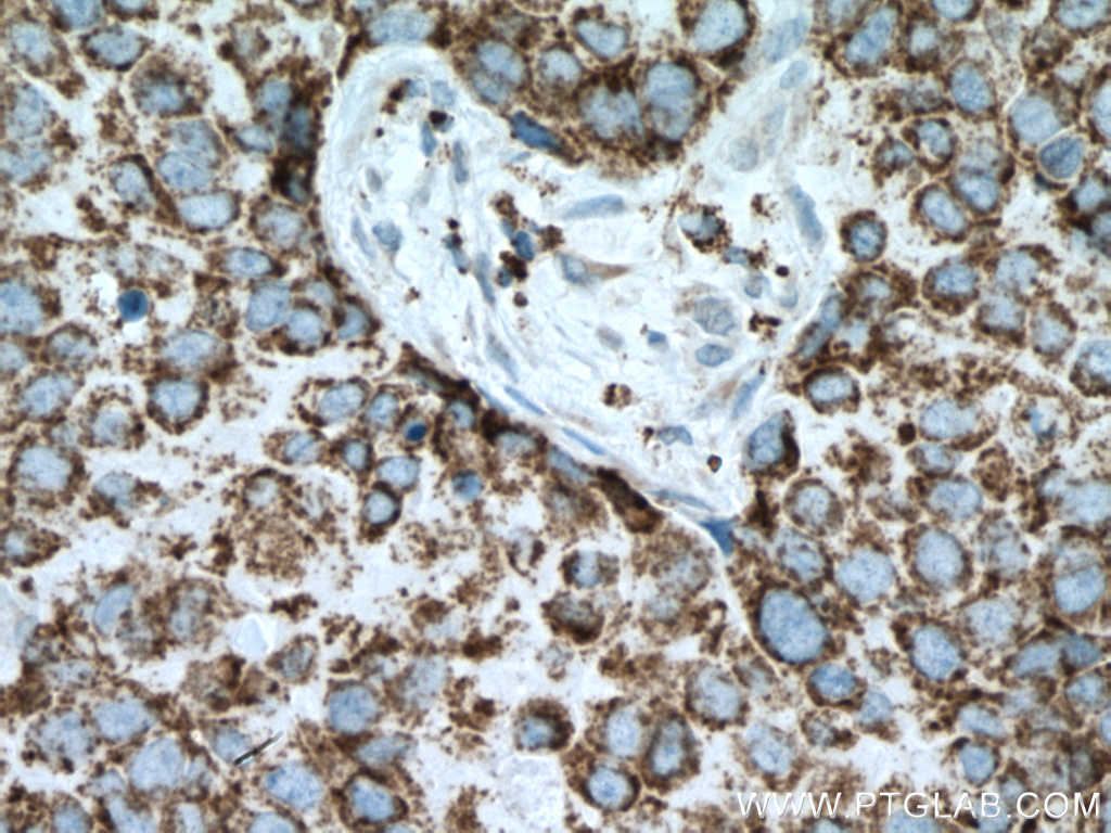 PCK2 Antibody 148921AP Proteintech