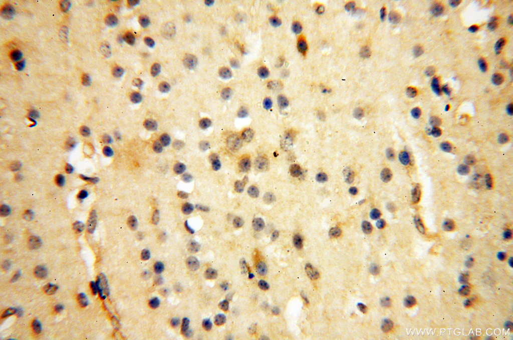 16470-1-AP;human brain