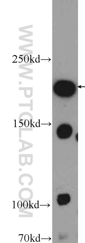 16470-1-AP;mouse brain tissue