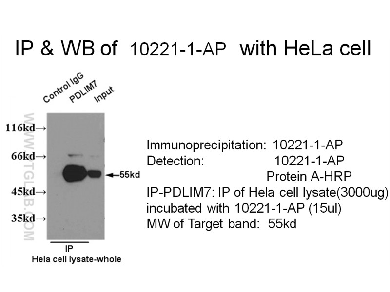10221-1-AP;HeLa cells