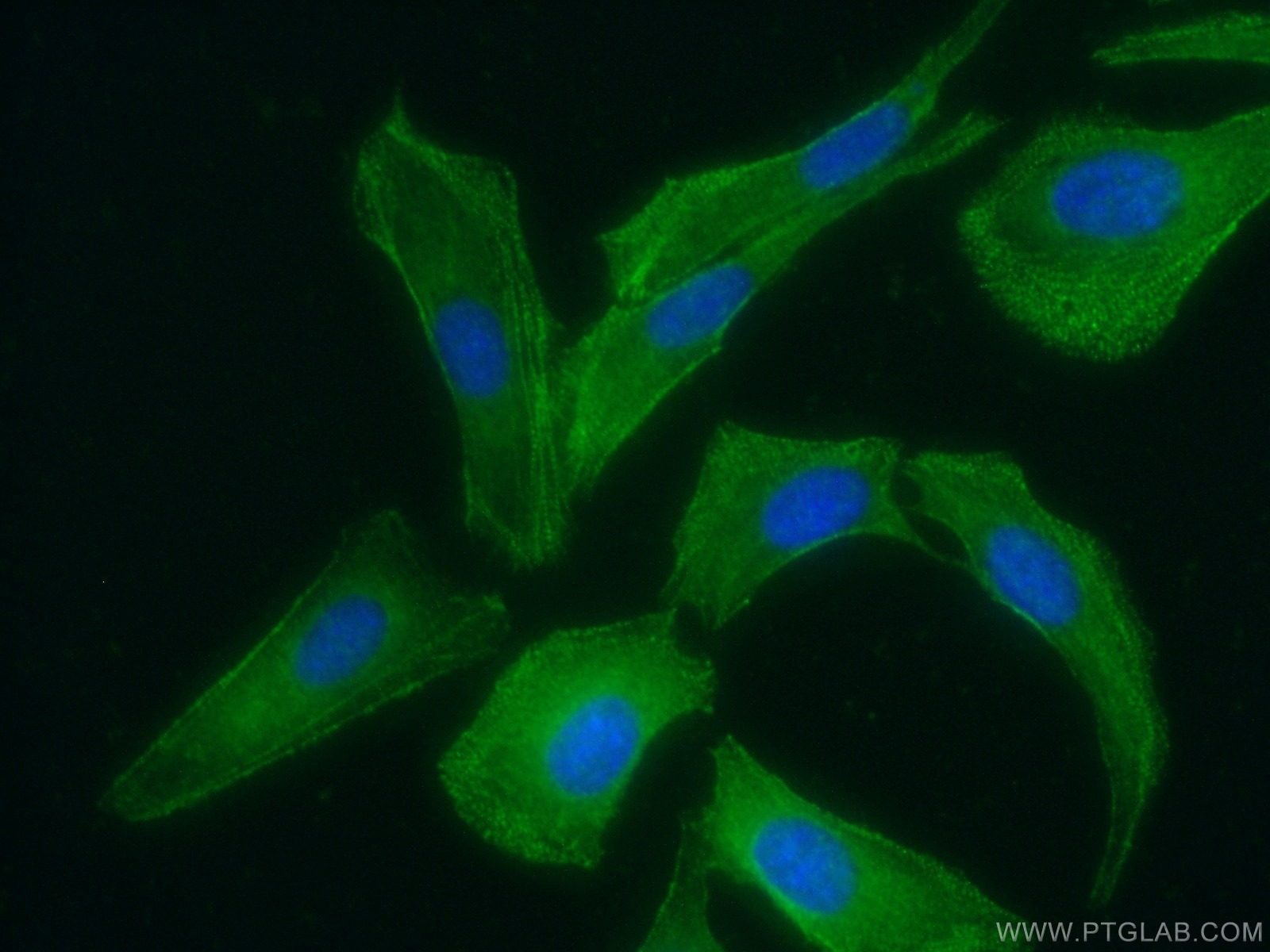 10221-1-AP;SKOV-3 cells