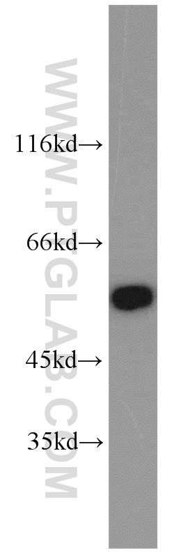 10221-1-AP;SKOV-3 cells