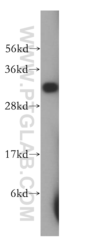 14901-1-AP;human kidney tissue