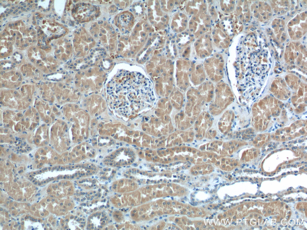 12545-1-AP;human kidney tissue