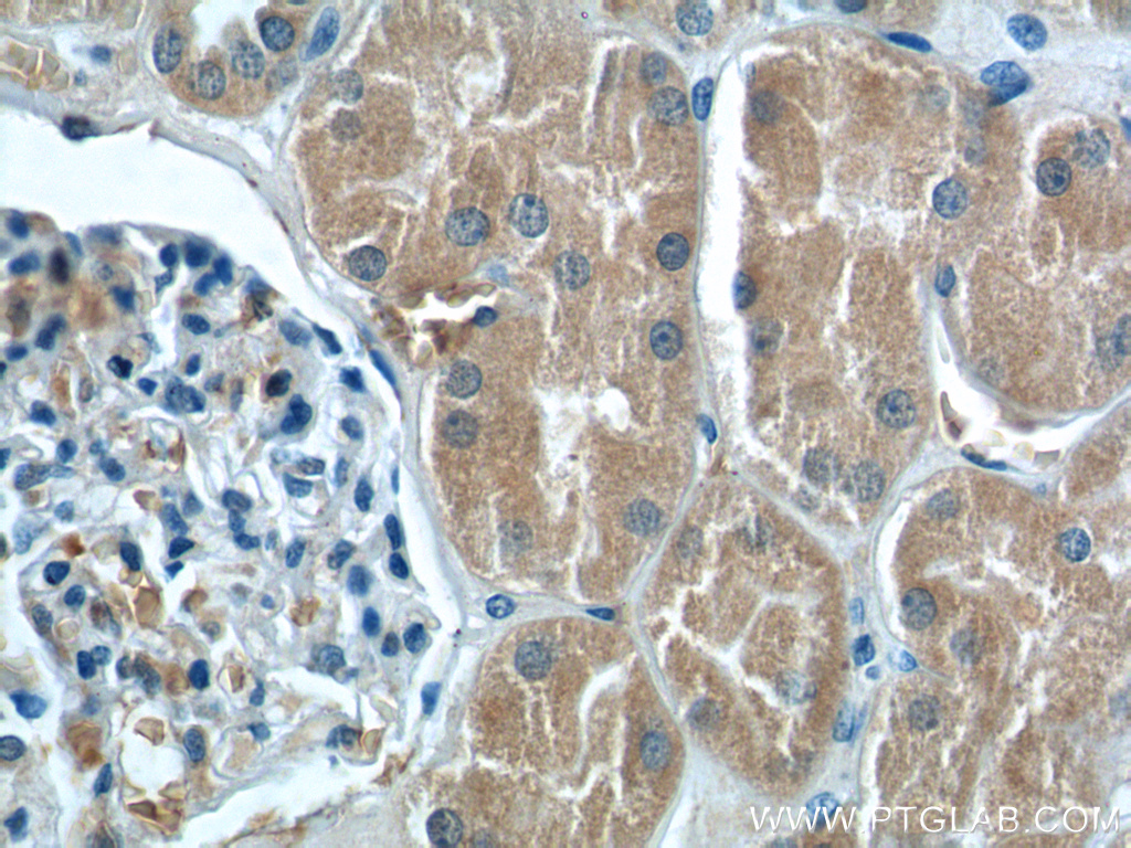 12545-1-AP;human kidney tissue