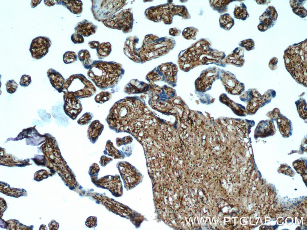 22522-1-AP;human placenta tissue
