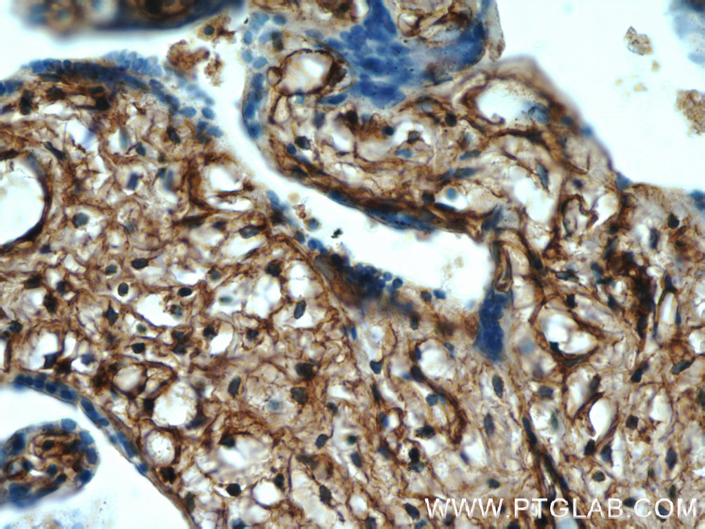 22522-1-AP;human placenta tissue