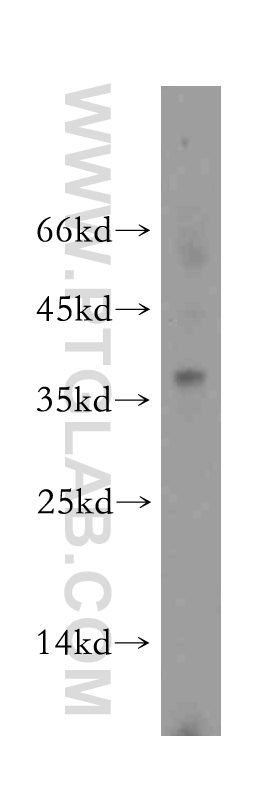 18082-1-AP;Apoptosised HeLa cell