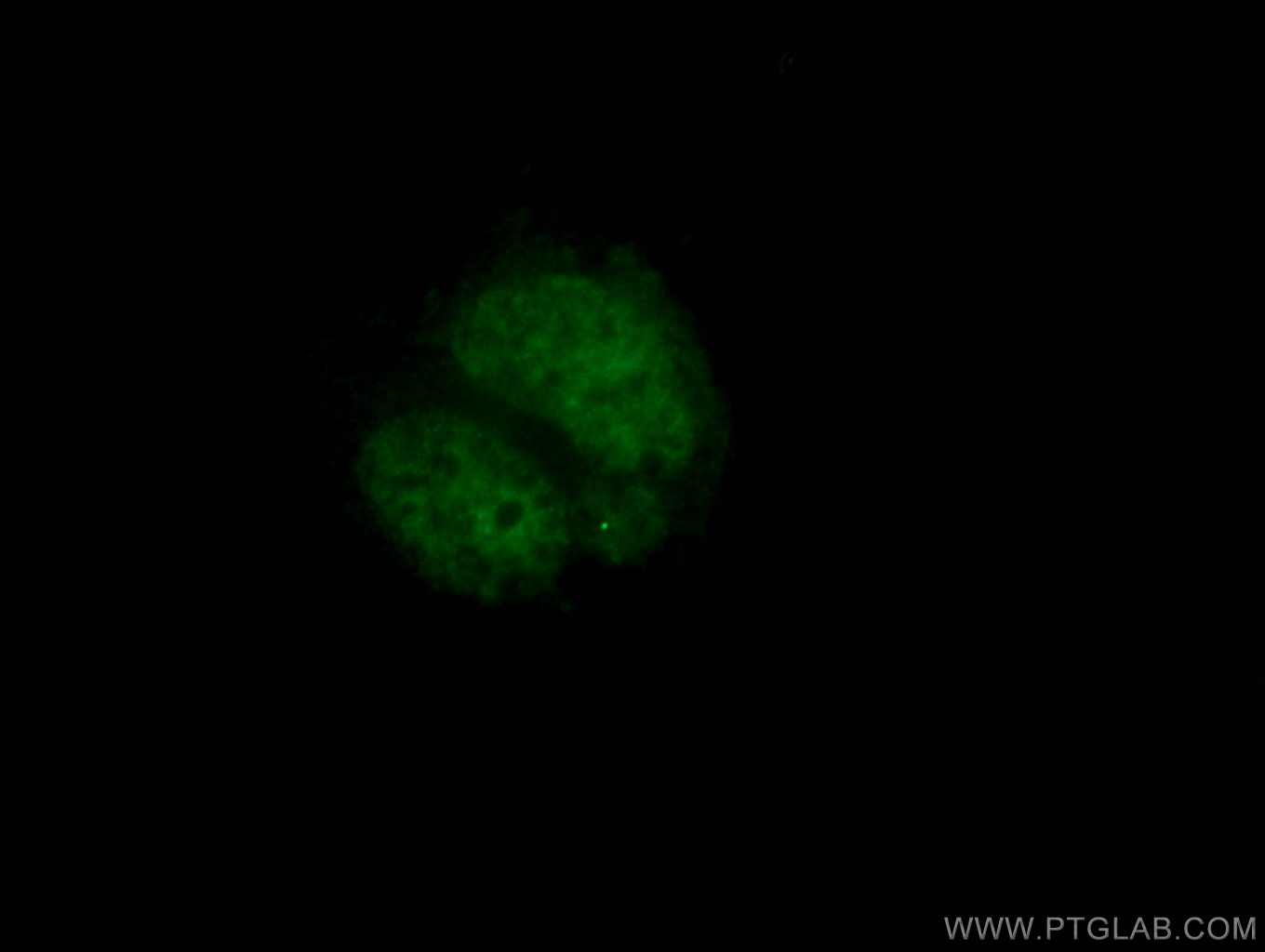 25276-1-AP;Neuro-2a cells