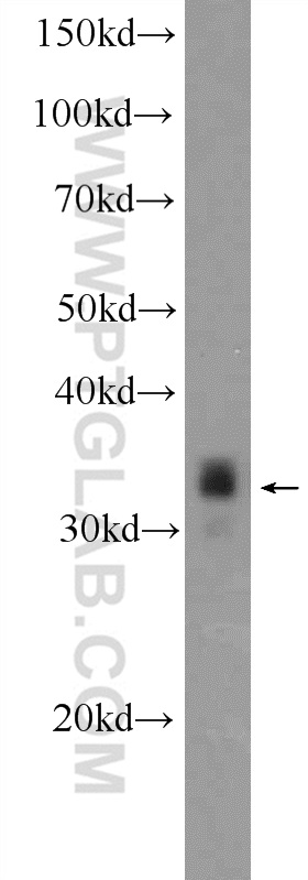 25276-1-AP;Neuro-2a cells
