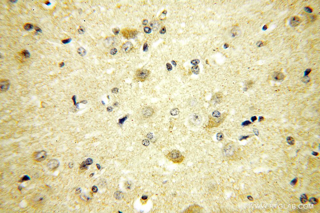 16906-1-AP;H-brain