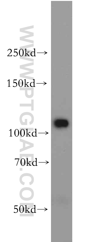 20584-1-AP;HepG2 cells