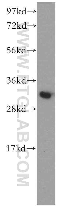 13110-1-AP;mouse lung tissue