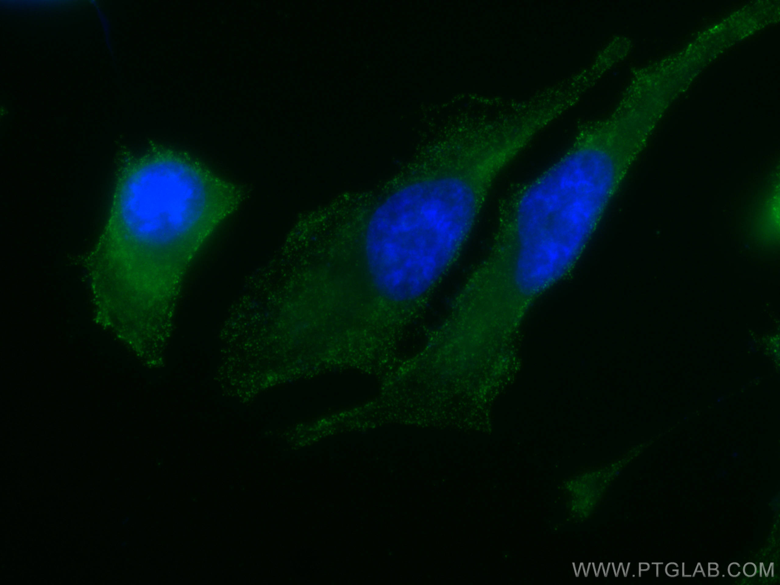 PKC Alpha Antibody 664211Ig Proteintech