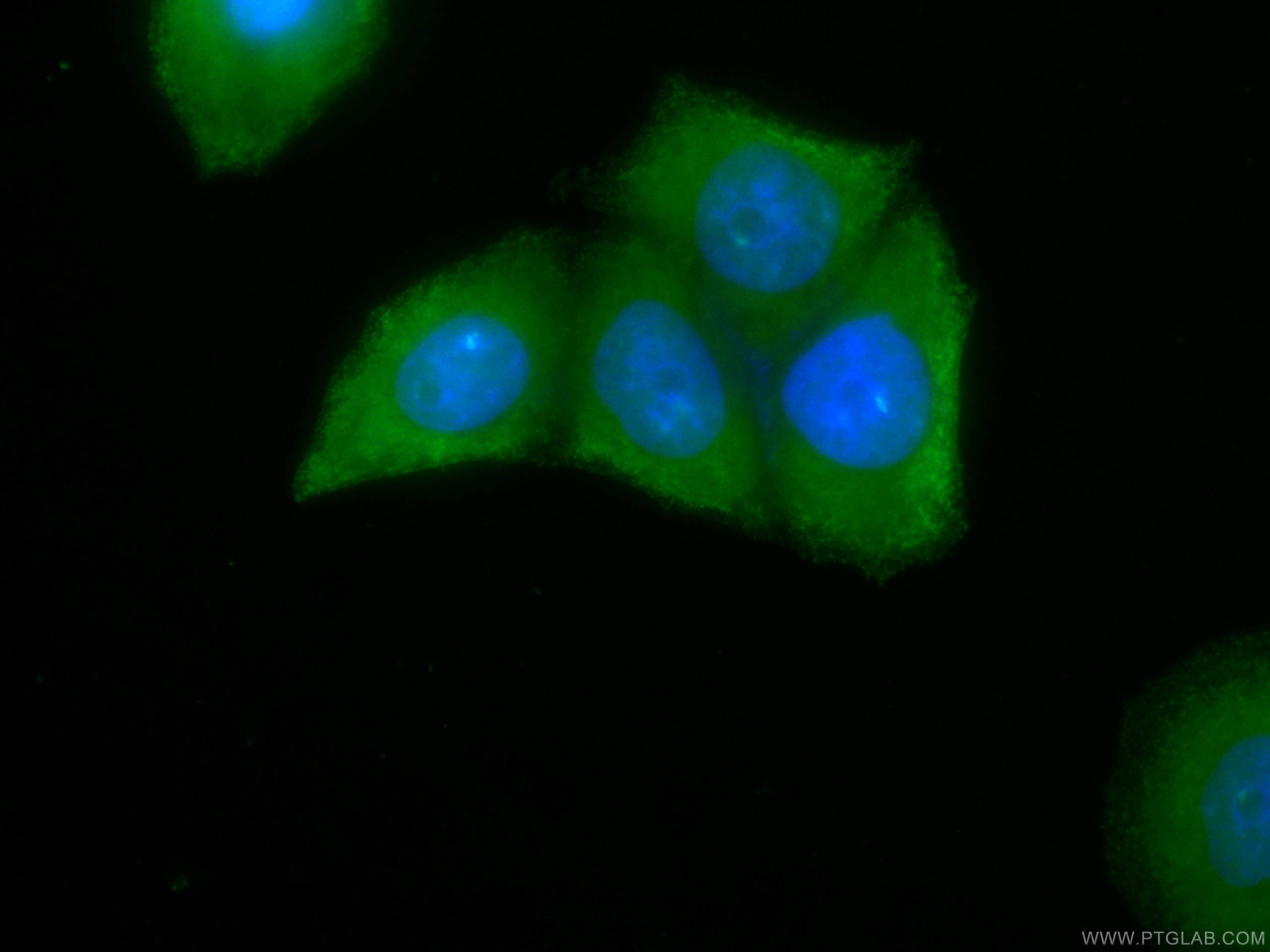 PKC Alpha Antibody CL48866421 Proteintech