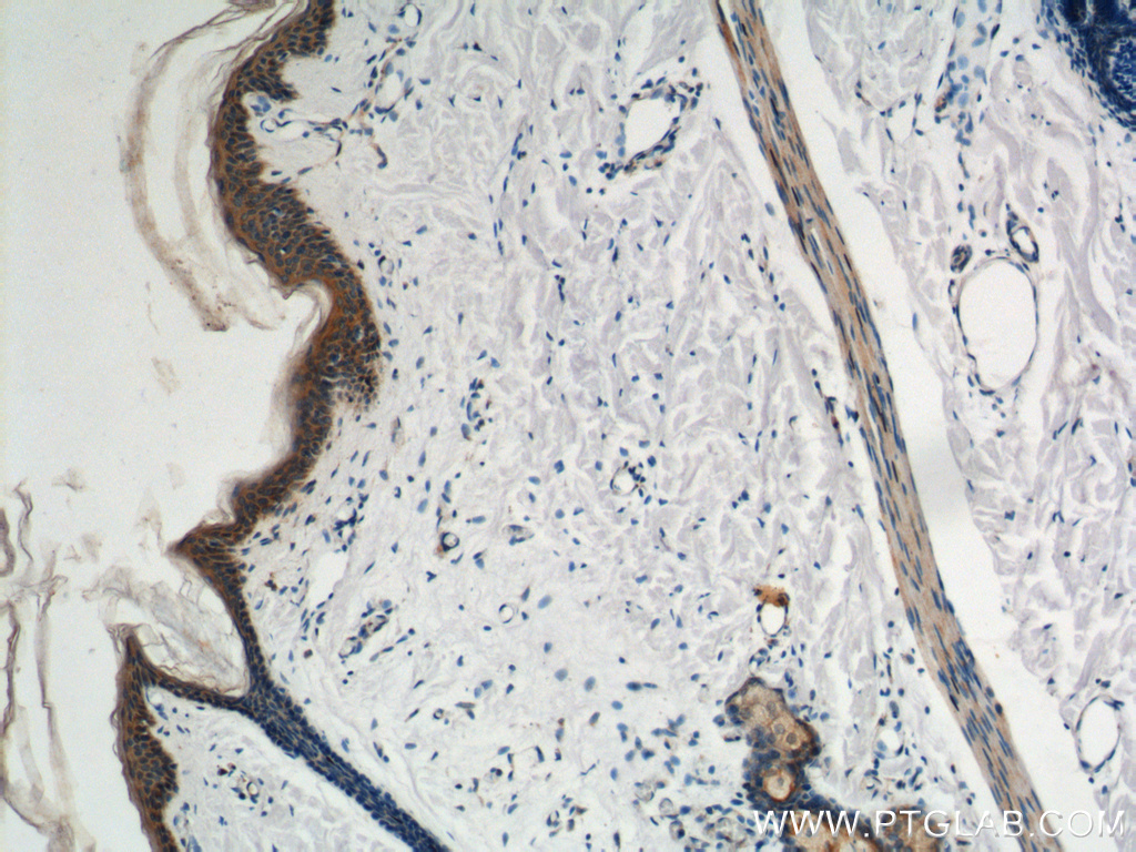18338-1-AP;human skin tissue
