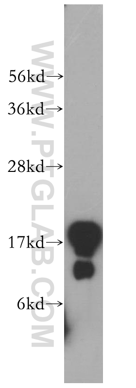 14868-1-AP;human testis tissue