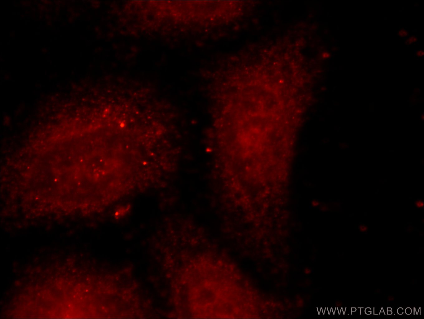 21935-1-AP;MCF-7 cells