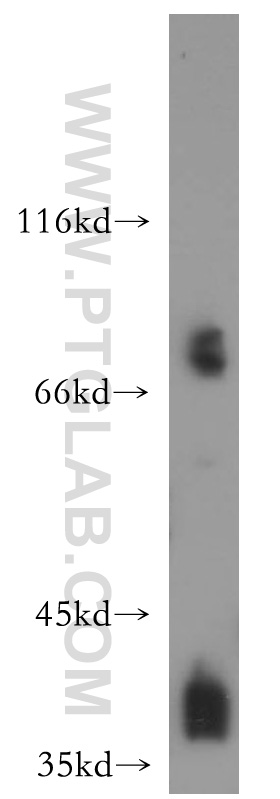 15923-1-AP;HEK-293 cells