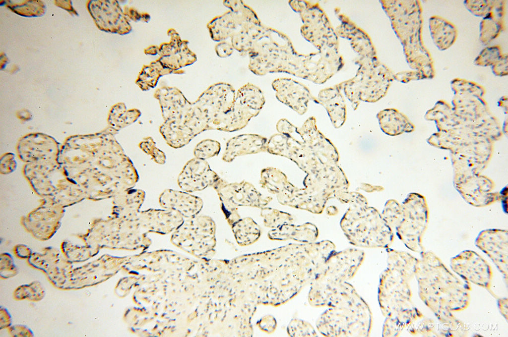 11800-1-AP;human placenta