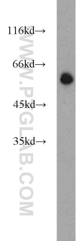 11800-1-AP;COLO 320 cells