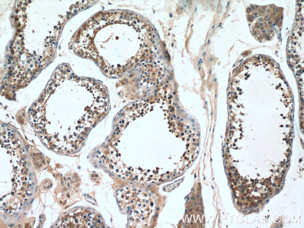 14005-1-AP;human testis tissue