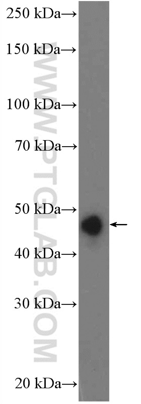 17991-1-AP;mouse brain tissue