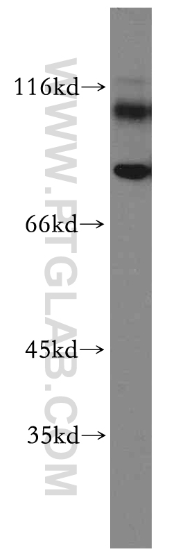 19946-1-AP;Y79 cells