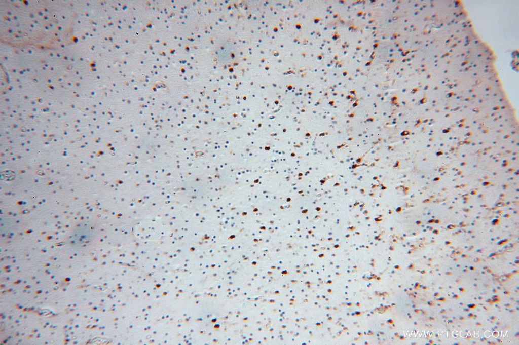 16352-1-AP;H-brain