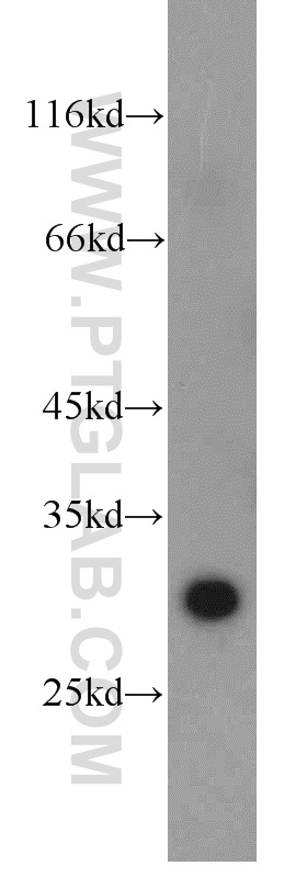 15976-1-AP;human liver tissue